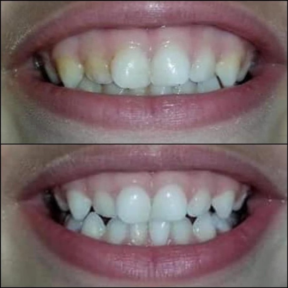 AP24 whitening toothpaste - Picture 7 of 7